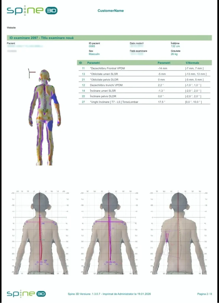Analiza posturala 3D Medano Clinic img1